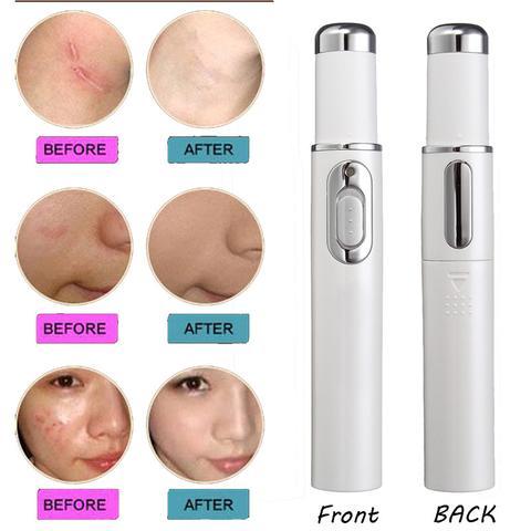 Blue Light Therapy Acne Laser Pen Soft Scar Wrinkle Removal